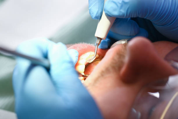 Best Dental Abscess Treatment in Wfield, IN