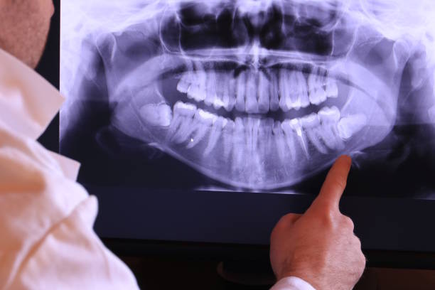 Best Emergency Denture Repair in Wfield, IN
