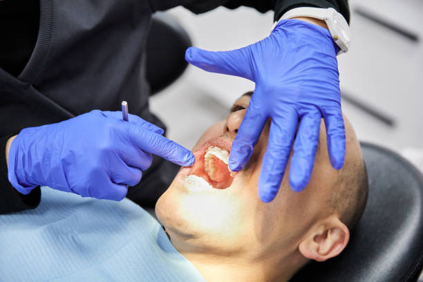 Best Broken or Chipped Tooth Repair in Wfield, IN