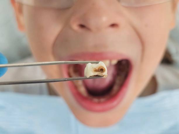 Best After-Hours Dental Care in Wfield, IN